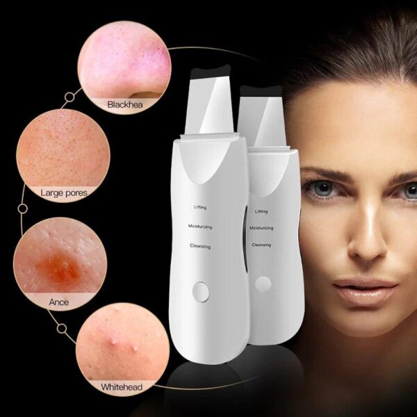 Ultrazvucna spatula za ciscenje lica