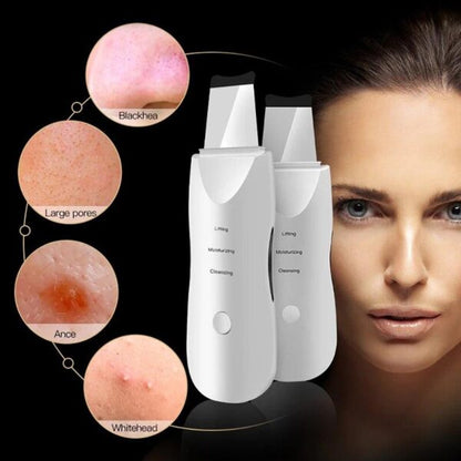 Ultrazvucna spatula za ciscenje lica