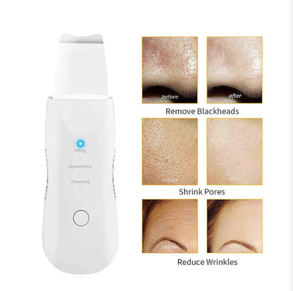 Ultrazvucna spatula za ciscenje lica