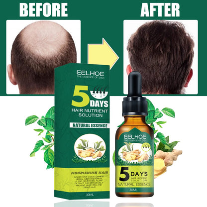 Serum protiv opadanja kose - Brzishop